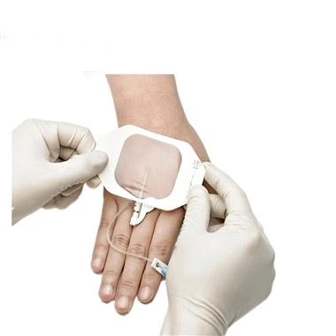 AMBILACIÓ IV CANNULA FIXENT DE LA VENDA